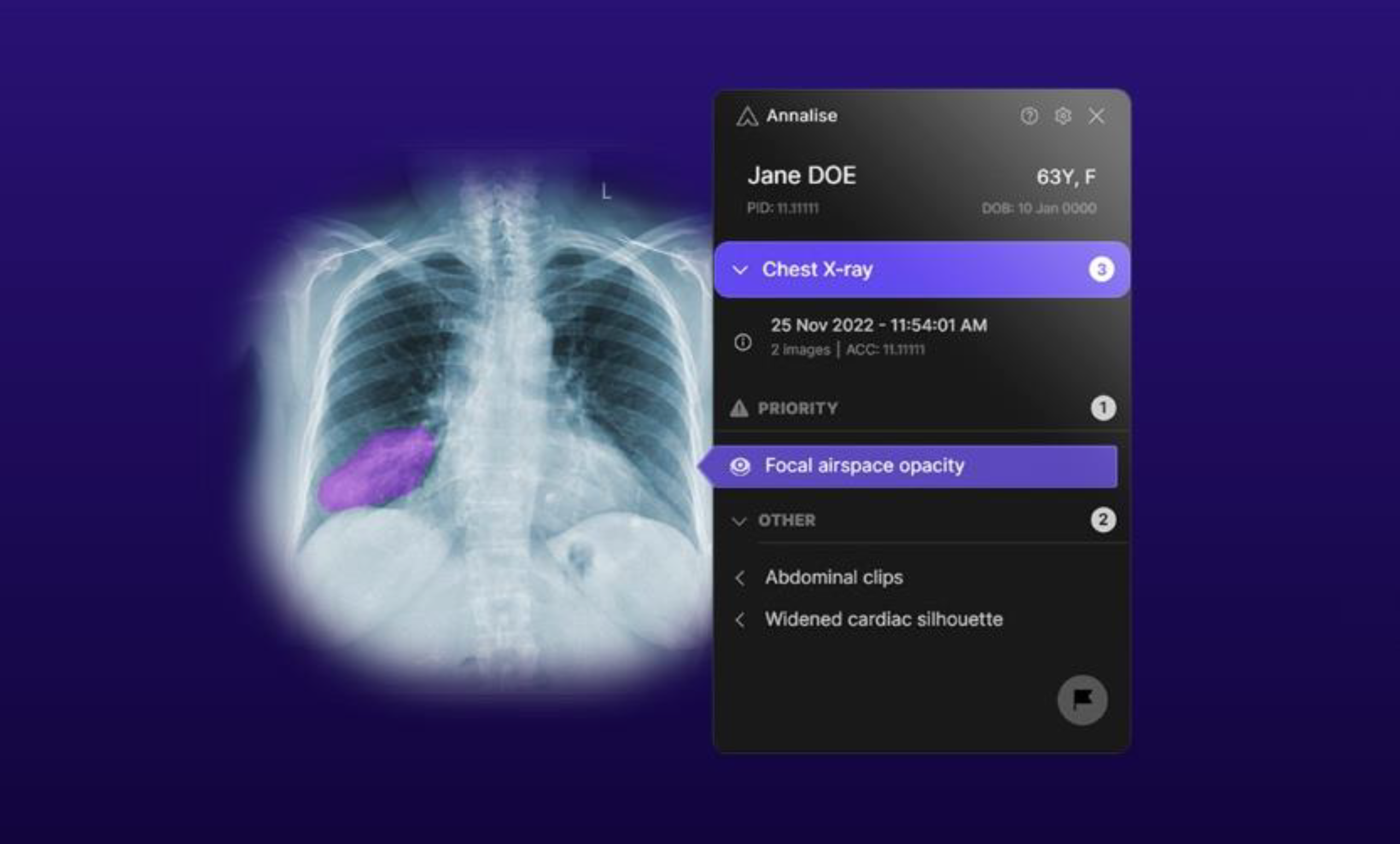 AI-Powered Diagnostic Solutions